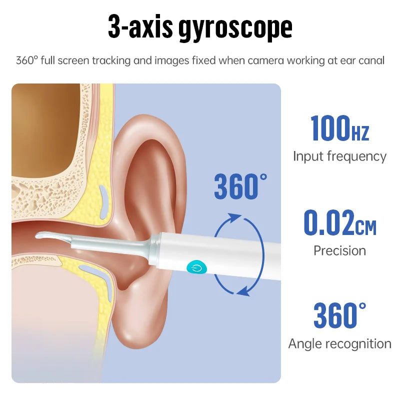 Smart Ear Cleaner – HD Cam, 360° View, Wireless for iPhone/Android