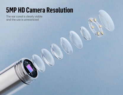 Smart Ear Cleaner – HD Cam, 360° View, Wireless for iPhone/Android